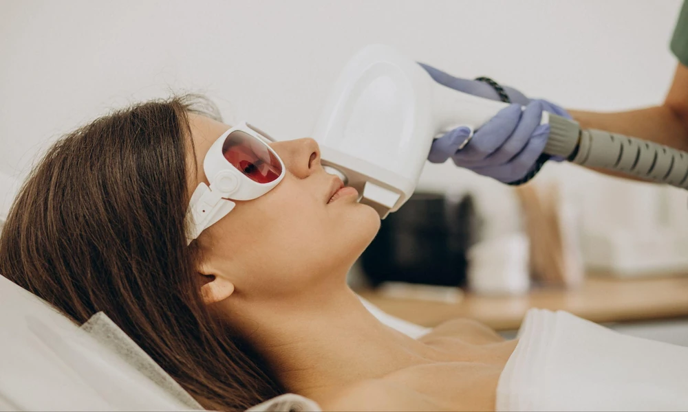4 Essential Facts About Laser Mole Removal Procedures